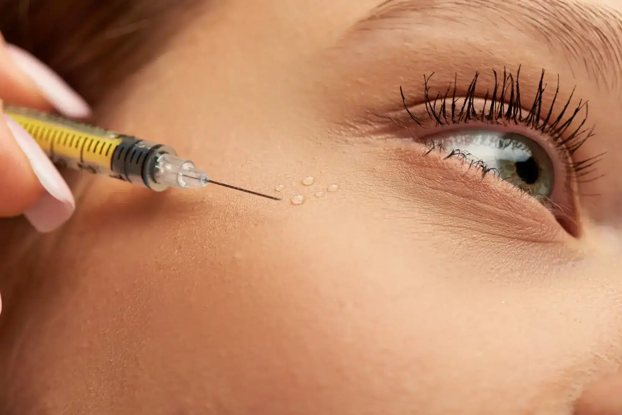 Cannula vs. Needle When and Why to Choose Each for Fillers Considerations for Practitioners