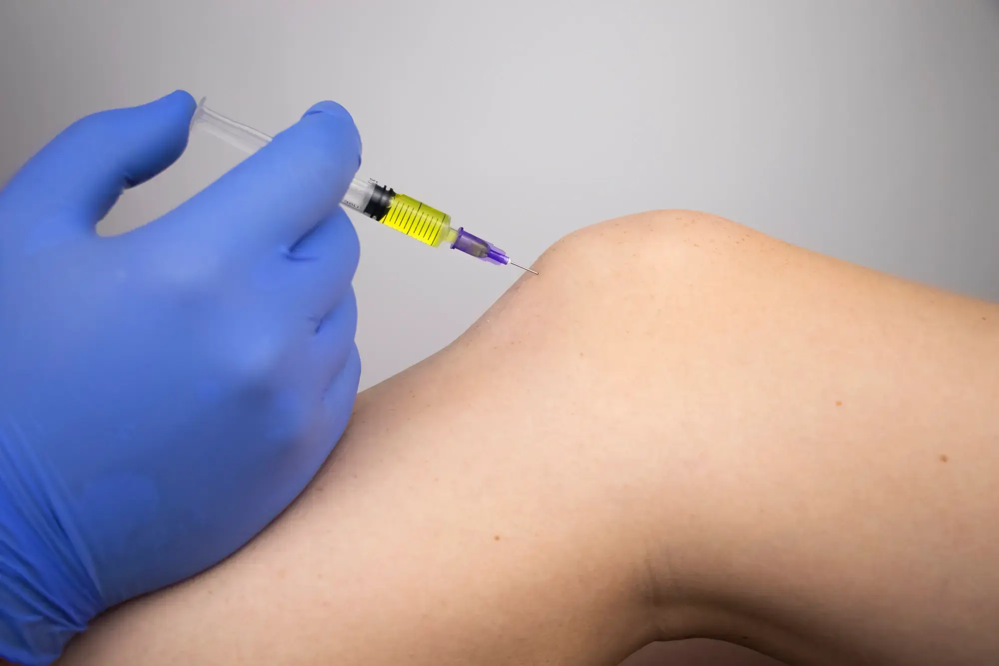Difference Between Orthovisc vs Synvisc Injection