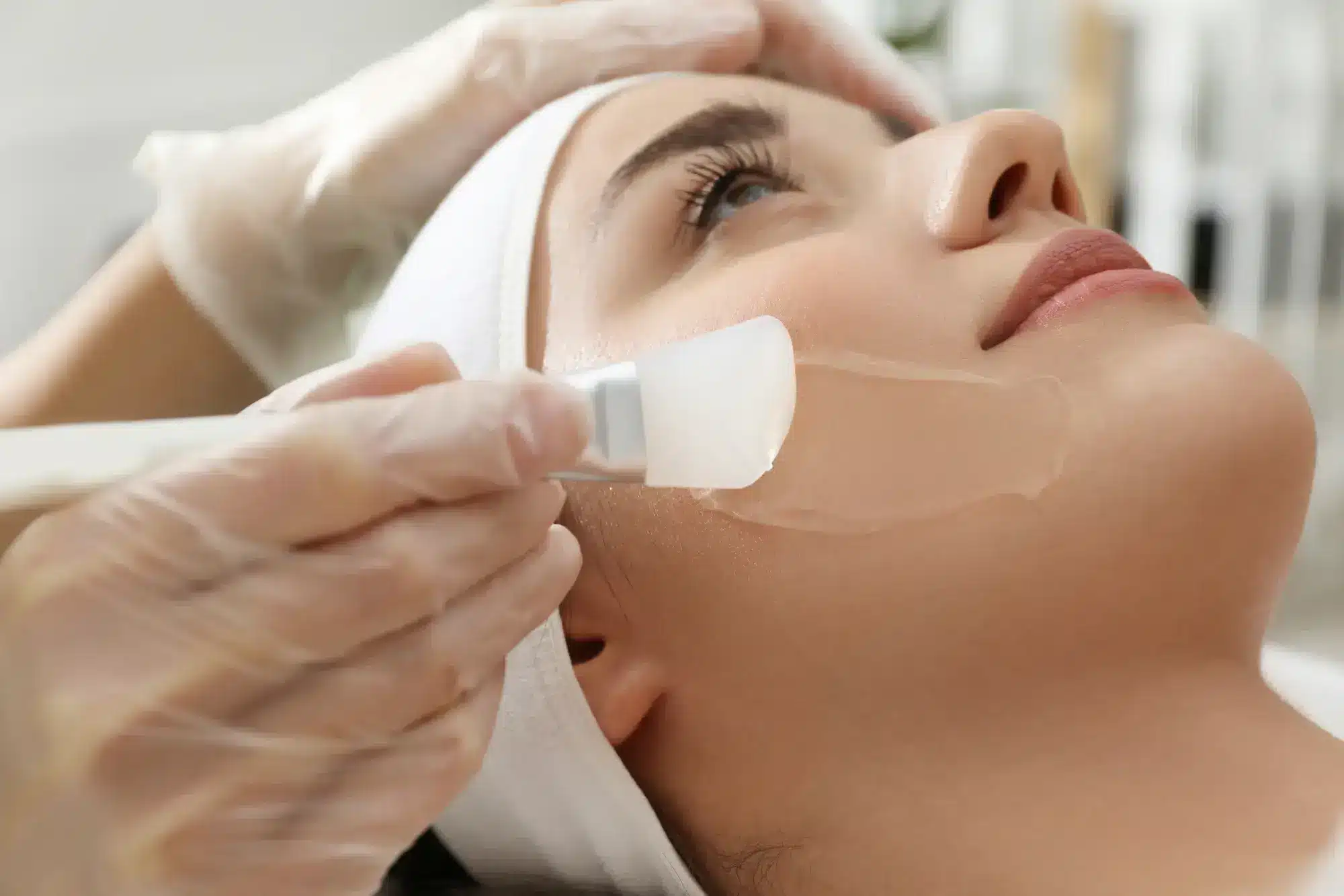 TCA Peels: Benefits for All Skin Types