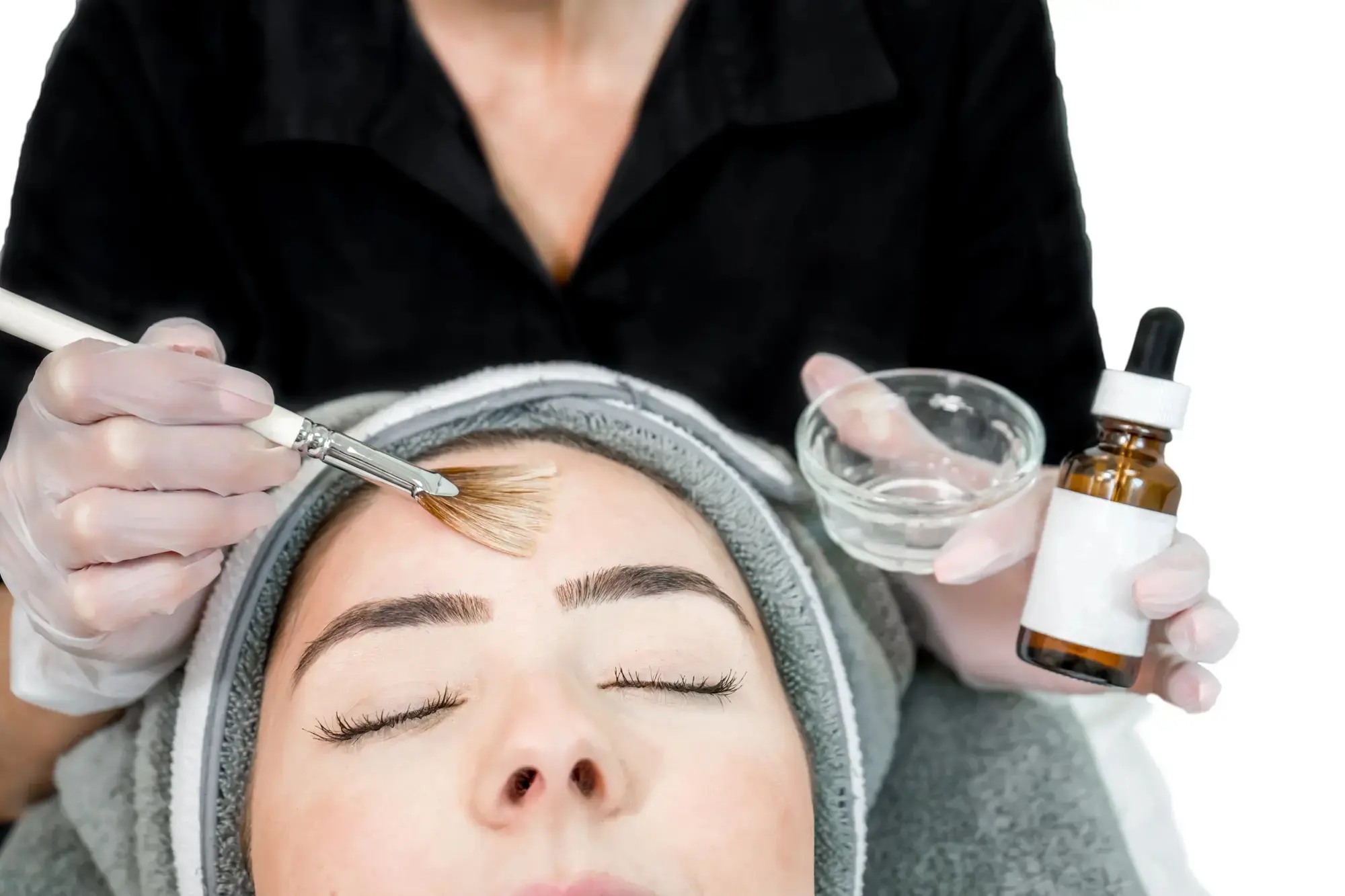 The Ultimate Guide to Chemical Peels Post Peel Care and Recovery